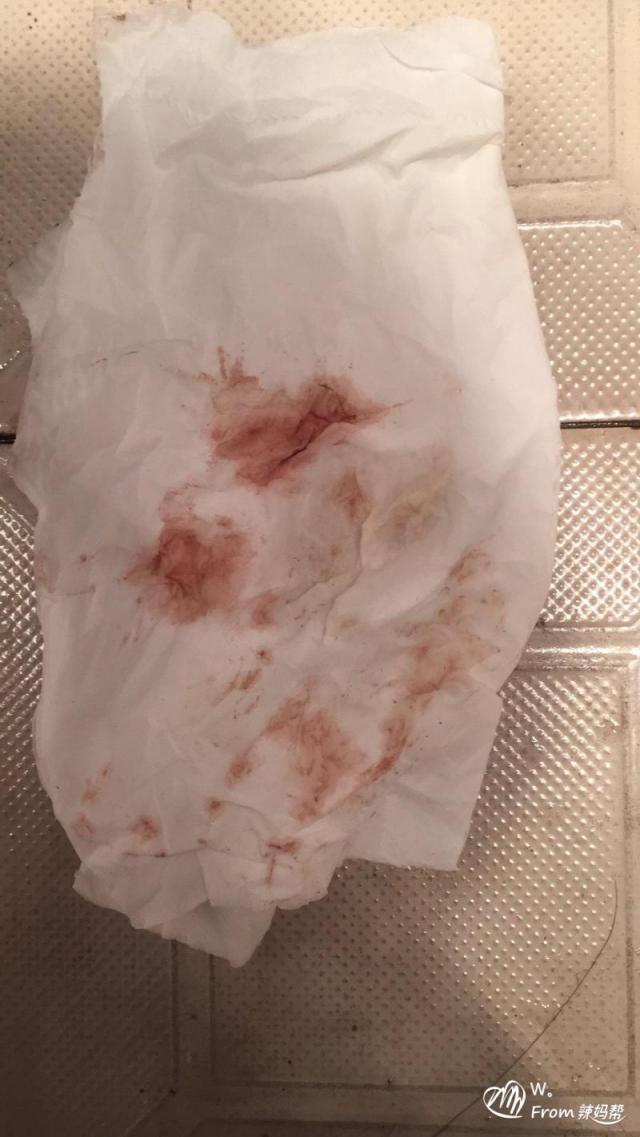 怀孕早期出血,黄体素真的有效吗?(图6) 促黄体生成素_黄体素_黄体不足