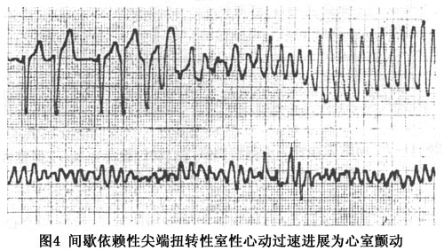 短QT间期综合征(图1) 双色球综合走势图近30期_短QT间期综合征_3d天牛图库综合彩报311期