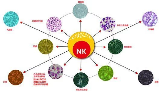 nk细胞