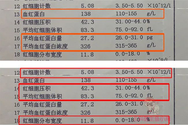地中海贫血_地海中贫血有哪些症状_地海中贫血有什么症状