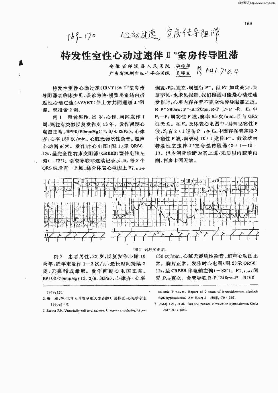 短QT间期综合征_赢在中国蓝天碧水间10期观后感_推女郎葛征65期