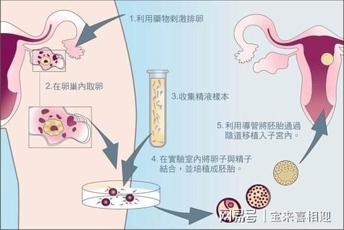 辅助生殖哪个医院便宜_做辅助生殖哪家医院便宜_辅助生殖