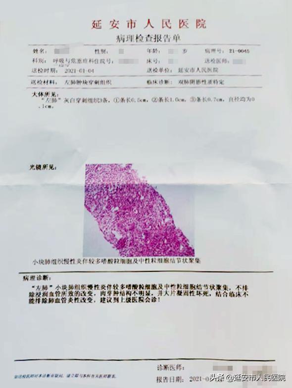 短QT间期综合征_征地区片综合地价_英短蓝猫尴尬期多久