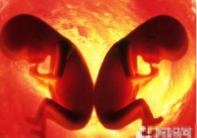 梦见生两对双胞胎_怎么生双胞胎_梦见自己生两对双胞胎