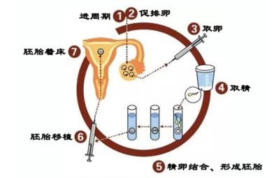 辅助生殖