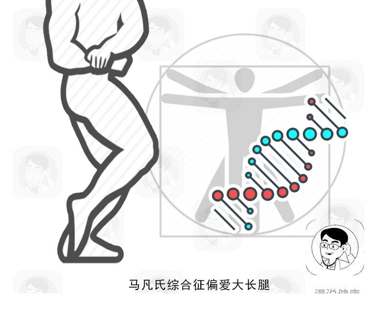 假日综合征和症_南山南马頴有早衰症么_马凡氏综合症