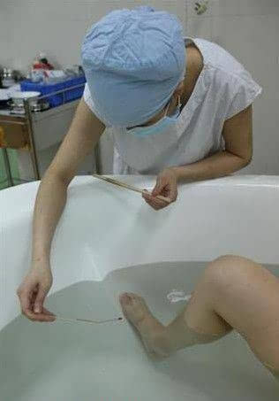 水中分娩