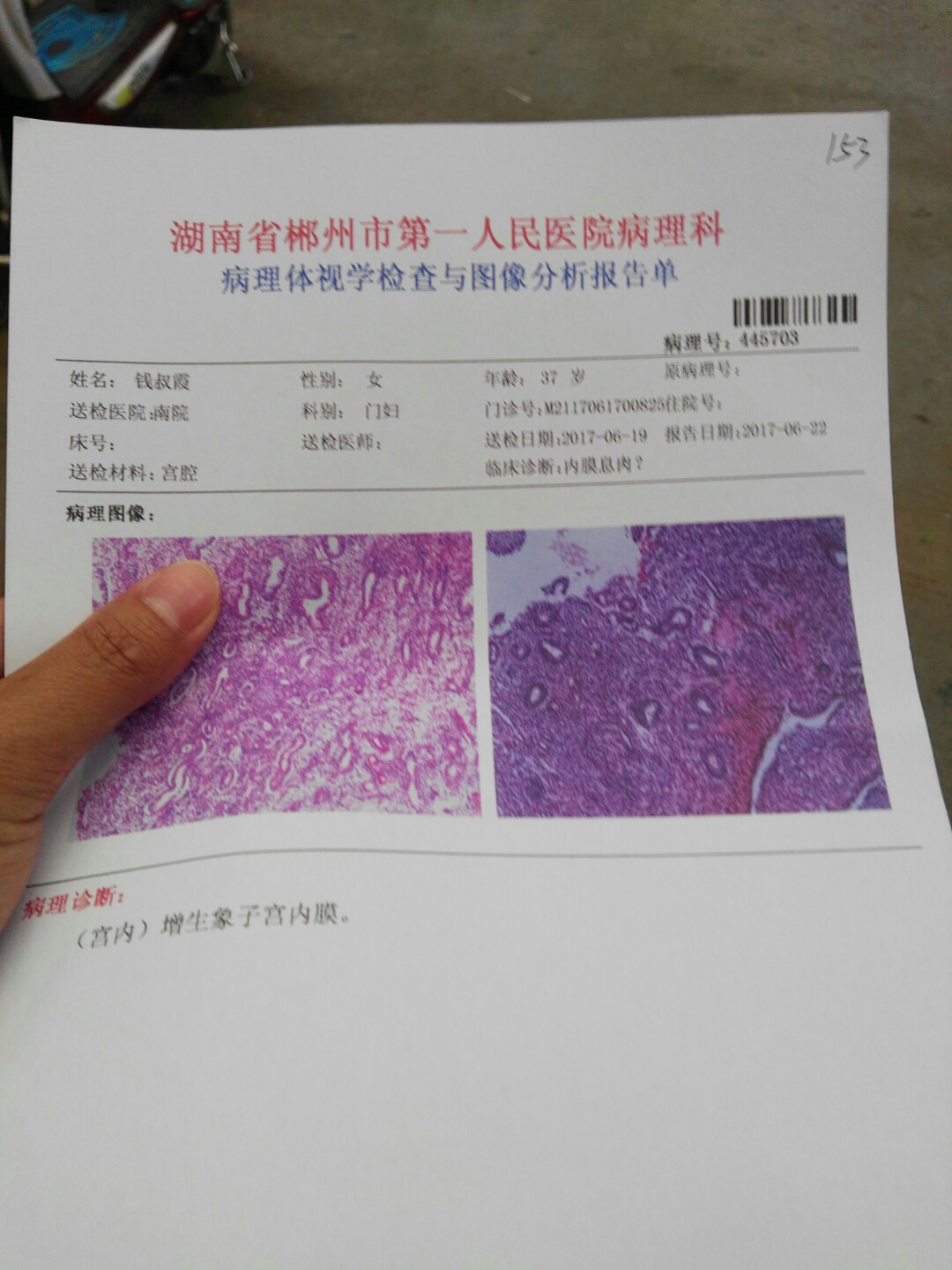 什么情况做宫腔镜检查_宫腔镜检查术_宫腔镜检查