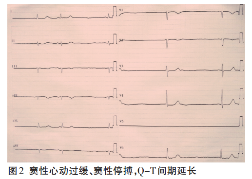 赢在中国蓝天碧水间10期观后感_长QT间期综合征_哈尔滨市区征地区片综合地价表2011