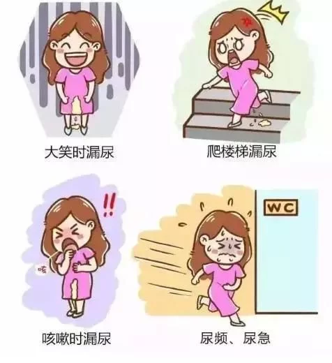 盆底肌修复