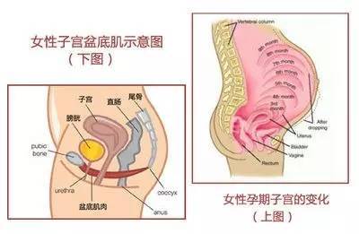 盆底肌康复训练_盆底肌修复_盆底肌康复有用吗