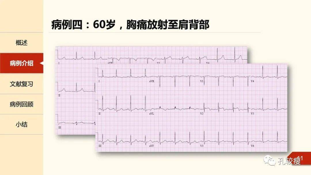 短QT间期综合征_哈尔滨市区征地区片综合地价表2011_3d天牛图库综合彩报311期