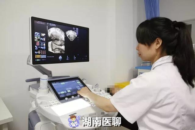 输卵管造影