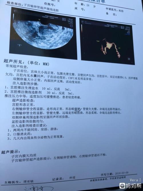 输卵管造影_输卵管超声造影疼不疼_造影疏通输卵管吗