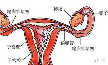 输卵管超声造影疼不疼_输卵管造影_造影疏通输卵管吗