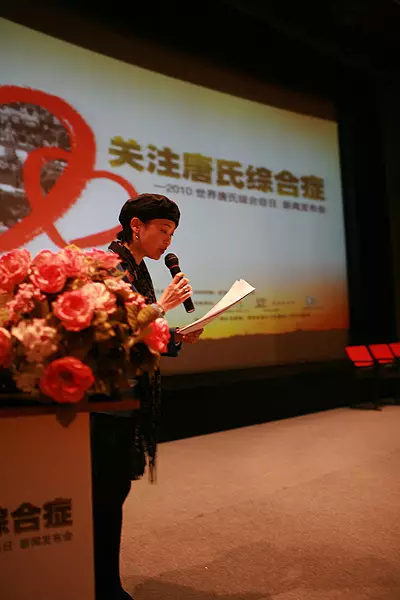 唐氏综合症