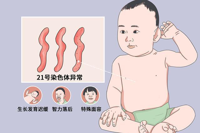 唐氏综合筛查是什么意思_拖延症的自我疗法:七周扫除拖延症_唐氏综合症