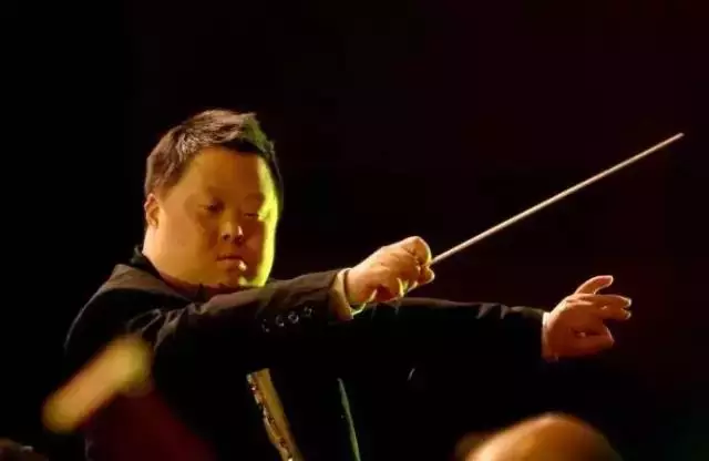 唐氏综合症