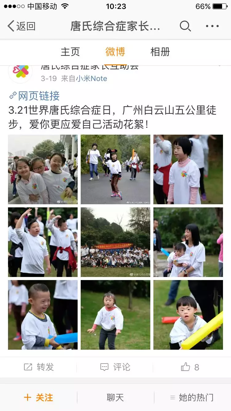 唐氏综合症