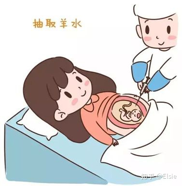 唐氏综合症_拖延症的自我疗法:七周扫除拖延症_唐氏综合筛查是什么意思