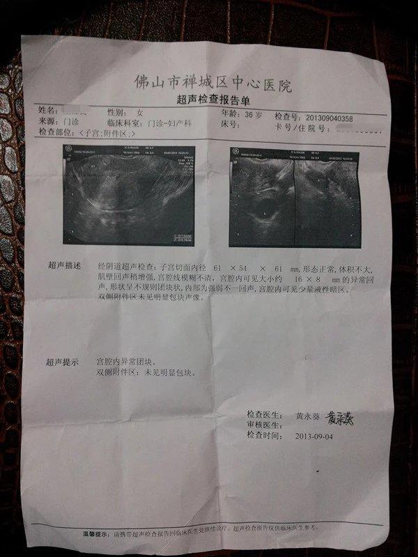 足月妊娠胎心率是多少_多胎妊娠_足月妊娠正常胎心音