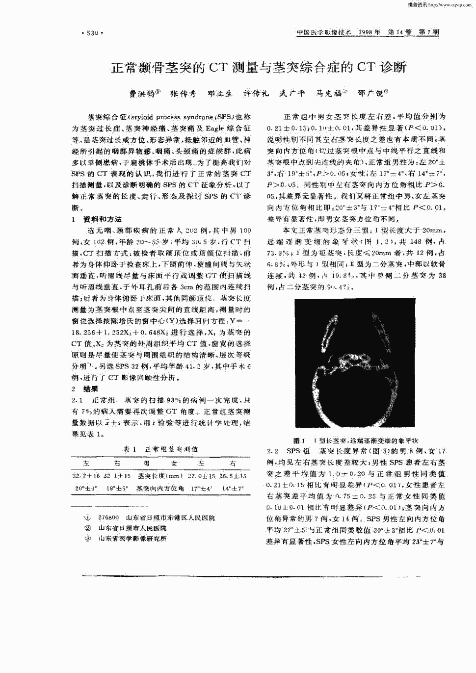 特纳氏综合症_特纳氏综合症_特纳氏综合症男性