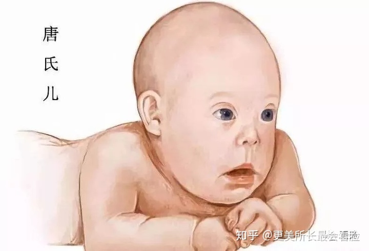 唐氏综合症_牧彤拖延症的自我疗法:七周扫除拖延症^^^好心态好前程:成功_拖延症的自我疗法:七周扫除拖延症