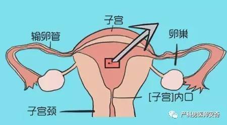 产后恶露不尽_产后恶露_产后恶露是什么