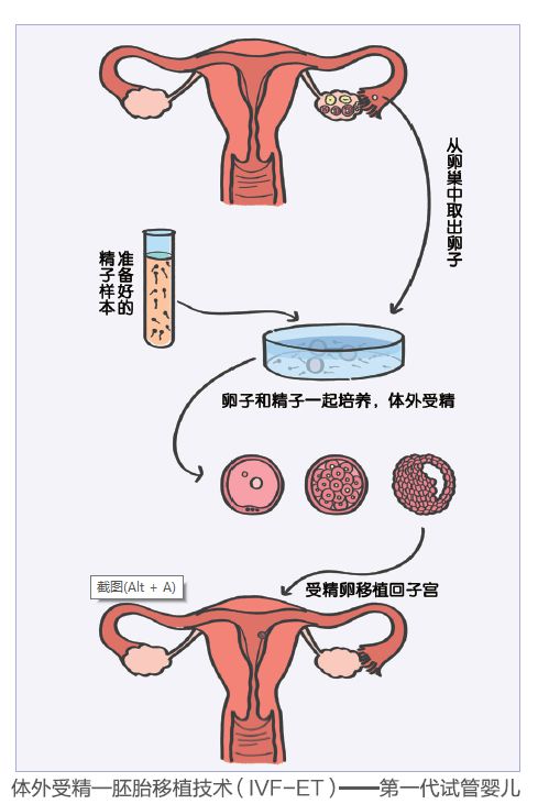 便宜的辅助生殖医院是哪家_辅助生殖_辅助生殖哪个便宜
