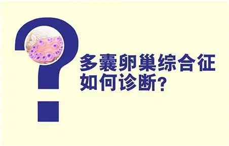 多囊卵巢