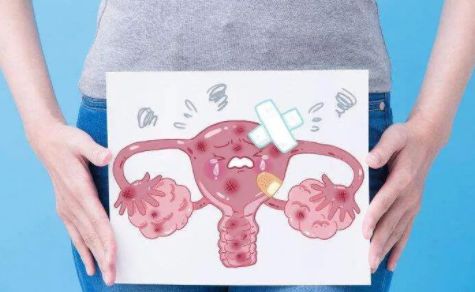 什么是子宫腺肌症_子宫腺肌症_子宫腺肌症的症状