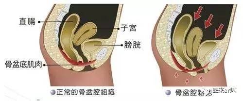 顺产侧切伤口_侧切_顺产图片 侧切