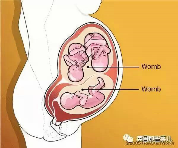 辅助生殖医院哪个便宜_哪个医院做辅助生殖便宜_辅助生殖