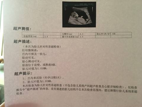 排卵多少天试纸强阳_排卵试纸强阳_试纸强阳后多久排卵 男孩