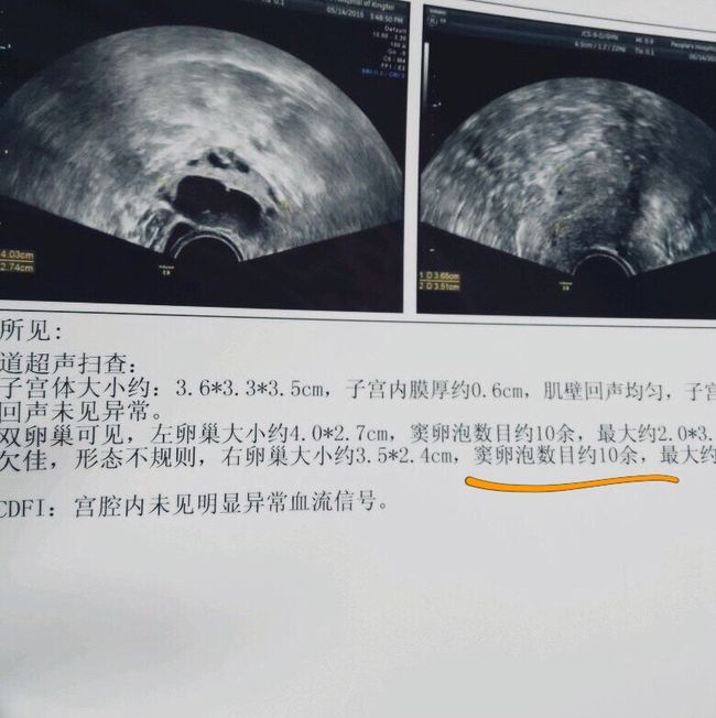 窦卵泡计数_穿刺大卵泡,小卵泡能长大吗_卵泡期用洗手液影响卵泡发育吗