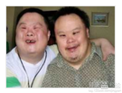 唐氏综合筛查是什么_唐氏综合症_囤积症对应的是什么症