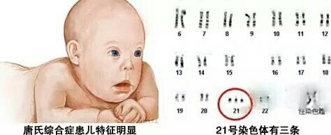 唐氏综合症_先天愚型 唐氏综合_拖延症的自我疗法:七周扫除拖延症