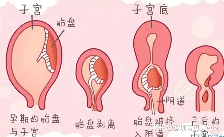 产后恶露