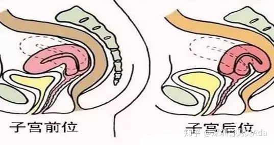 产后恶露