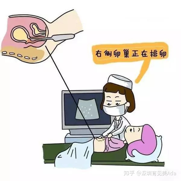 产后恶露