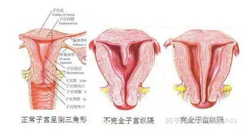 产后恶露