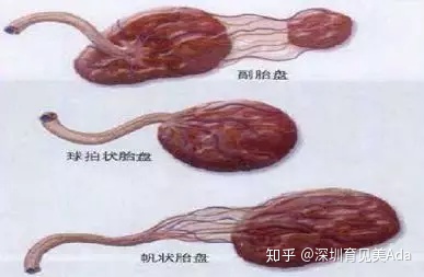 产后恶露