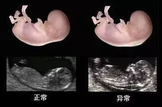 nt检查