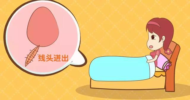 侧切