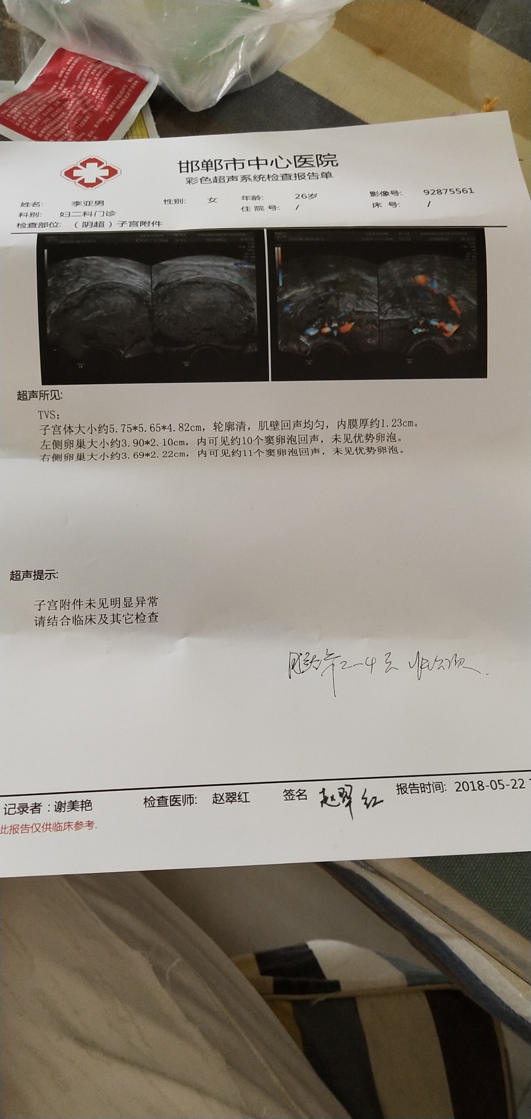 有卵泡不排卵泡会变成什么_窦卵泡计数_卵泡期卵泡多大