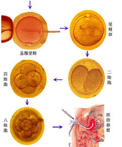 辅助生殖哪个便宜_那做辅助生殖便宜_辅助生殖