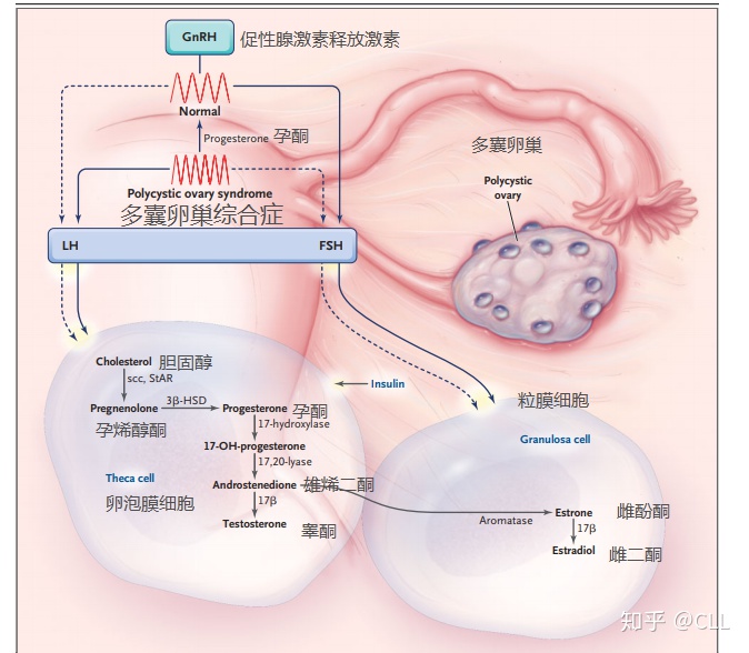 多卵巢多囊严重吗_多囊卵巢_卵巢有几个卵泡是多囊卵巢