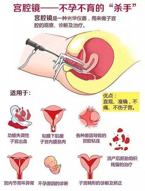 北京复兴医院宫腔镜检查_宫腔镜检查_宫腔环境检查