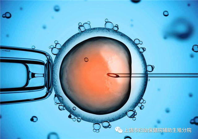 辅助生殖_做辅助生殖便宜医院_哪里辅助生殖医院便宜