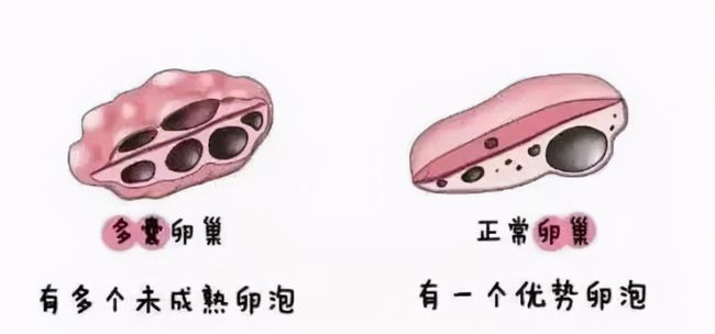 卵泡期卵泡多大_卵泡期雌二醇偏高促卵泡成熟激素偏低怎么办_窦卵泡计数